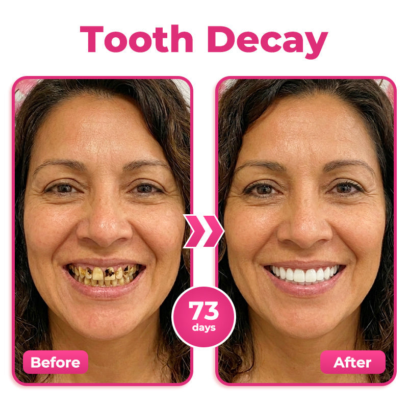 🇺🇸🦷  Natravor® Thismile NH-10 Toothpaste Serum for Enamel & Gum Care – Advanced Therapypy
