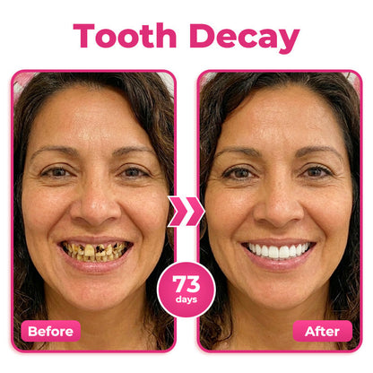🇺🇸🦷  Natravor® Thismile NH-10 Toothpaste Serum for Enamel & Gum Care – Advanced Therapypy