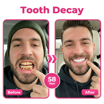 🇺🇸🦷  Natravor® Thismile NH-10 Toothpaste Serum for Enamel & Gum Care – Advanced Therapypy