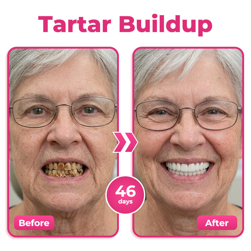 🇺🇸🦷  Natravor® Thismile NH-10 Toothpaste Serum for Enamel & Gum Care – Advanced Therapypy