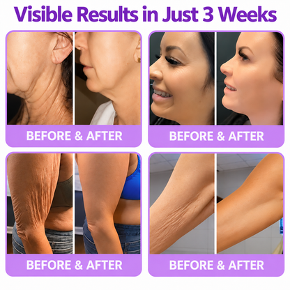 Natravor®🎗️ PDRN Multi-Peptide Firming Body Cream | Anti-Aging Skincare, Deep Hydration, Firming & Lifting Care for Smoother, More Radiant-Looking Skin（c）