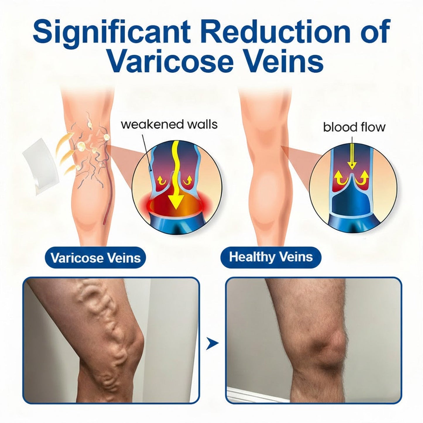 🏆🇺🇸👨‍⚕️✅Natravor®  VeinEase Microneedle Care Patch⚡Instant Relief, Long-Term Results