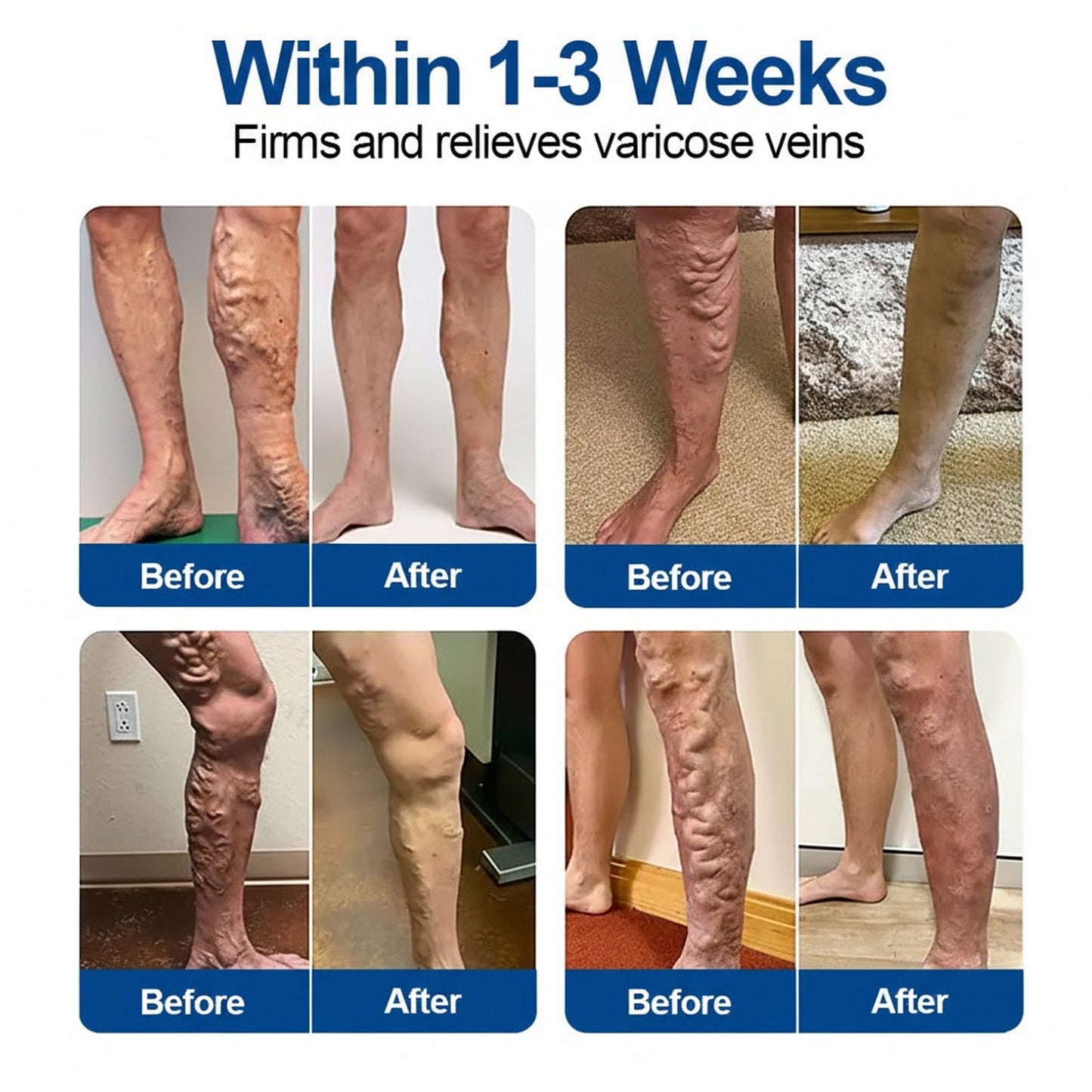🏆🇺🇸👨‍⚕️✅Natravor®  VeinEase Microneedle Care Patch⚡Instant Relief, Long-Term Results