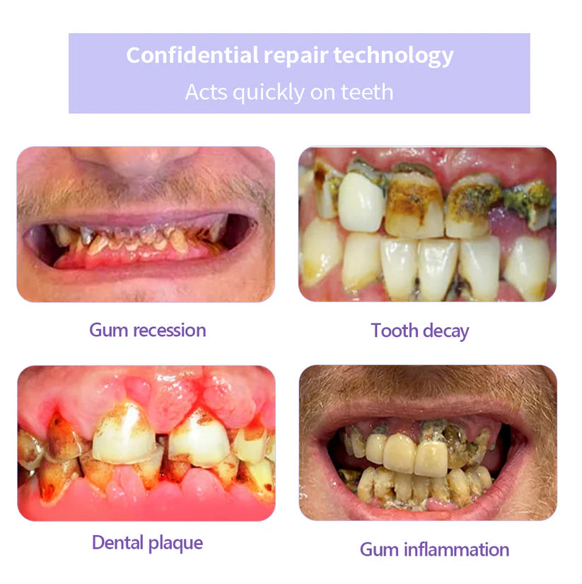 🦷✨𝐍𝐚𝐭𝐫𝐚𝐯𝐨𝐫® Mineral Tooth Repair Powder™ Advanced Enamel Restoration & Gum Care Formula