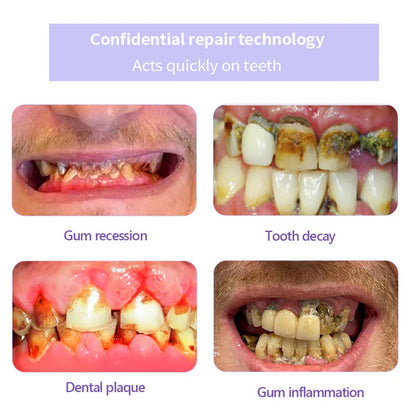 🦷✨𝐍𝐚𝐭𝐫𝐚𝐯𝐨𝐫® Mineral Tooth Repair Powder™ Advanced Enamel Restoration & Gum Care Formula