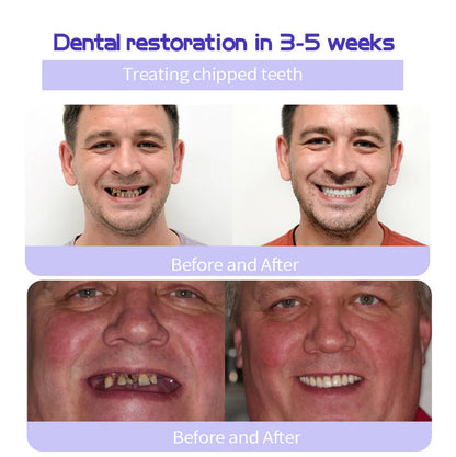 🦷✨𝐍𝐚𝐭𝐫𝐚𝐯𝐨𝐫® Mineral Tooth Repair Powder™ Advanced Enamel Restoration & Gum Care Formula